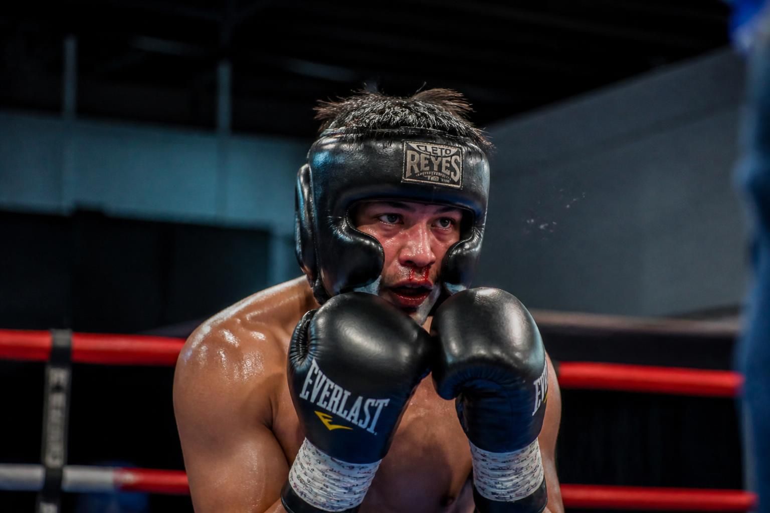découvrez comment choisir le protège-dents idéal pour la boxe afin de protéger efficacement vos dents et éviter de les casser dès le premier round. conseils et guide d'achat.